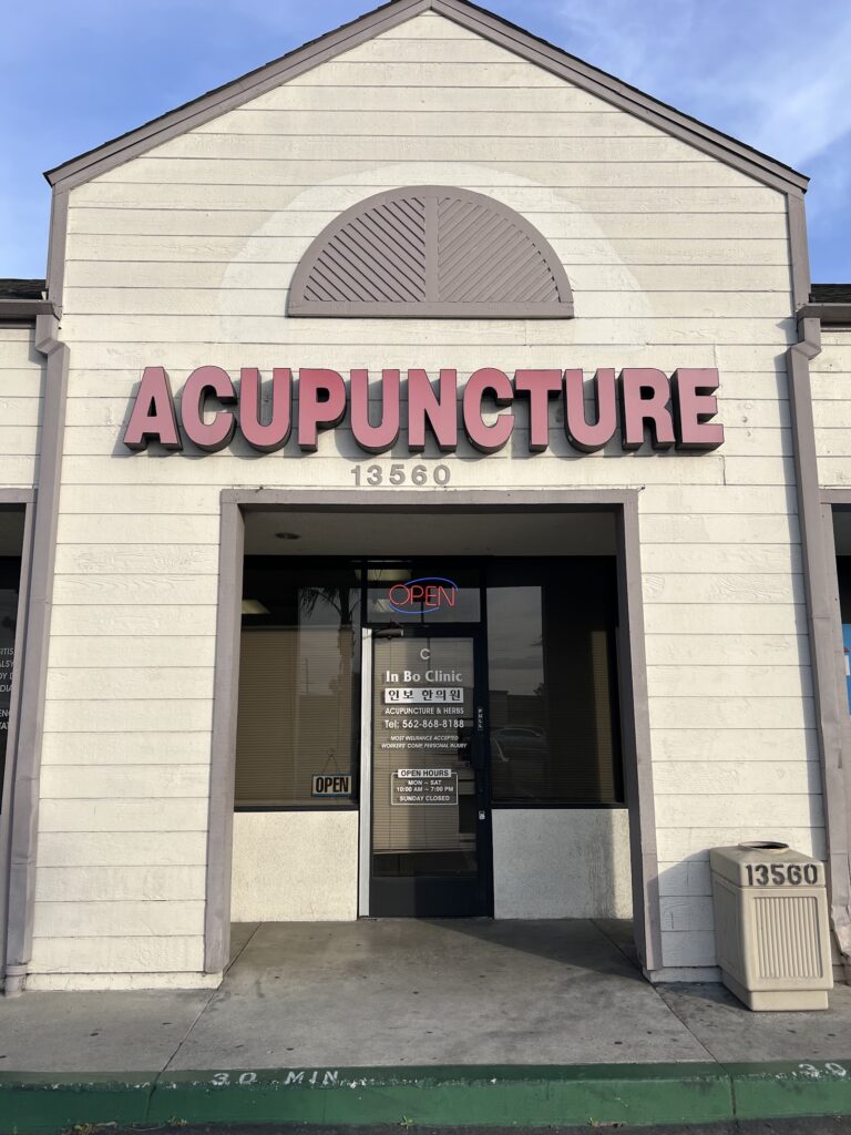 Acupuncture