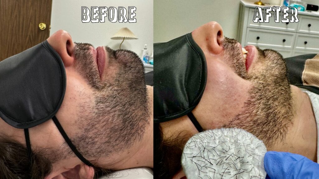 Electrolysis Hair Removal Lab